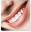 Implantes dentales: el arte de la perfección en la sonrisa